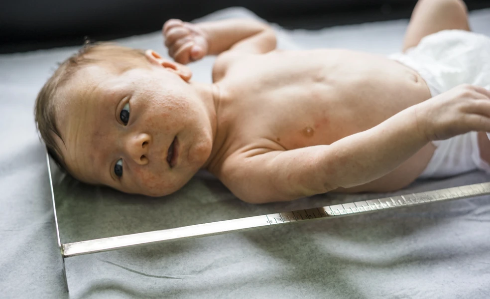 Neonatálny herpes