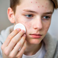 Puberta u chlapcov: Keď sa z vášho syna stane čudný spolubývajúci