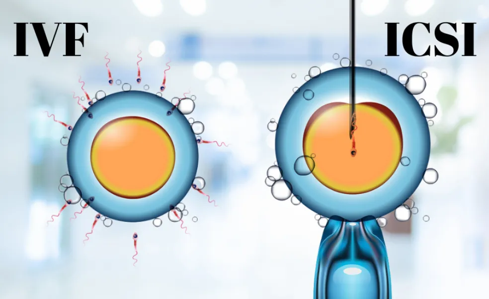 Rozdiel medzi ICSI a bežným IVF