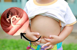 Pásomnica detská – aké príznaky u dieťaťa na ňu upozorňujú?