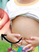 Pásomnica detská – aké príznaky u dieťaťa na ňu upozorňujú?