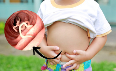 Pásomnica detská – aké príznaky u dieťaťa na ňu upozorňujú?