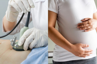 Amniocentéza – kedy sa robí a čo všetko odhalí? Aké sú riziká?