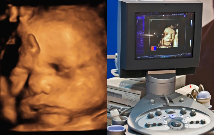 3D ultrazvuk 4D ultrazvuk