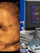 Chystáte sa na 3D/4D ultrazvuk? Toto všetko je dobré vedieť vopred!