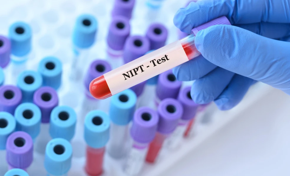 neinvazívne prenatálne testy