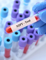 Neinvazívne prenatálne testy (NIPT) v tehotenstve – čo dokážu odhaliť?