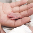 Edwardsov syndróm je závažnou diagnózou. Čo by mali vedieť budúci rodičia?
