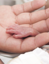 Edwardsov syndróm je závažnou diagnózou. Čo by mali vedieť budúci rodičia?