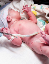 Zaujímavosti o pupočnej šnúre: 10 faktov, ktoré mamičky často netušia