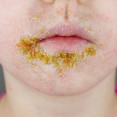 Impetigo u detí: Časté kožné ochorenie, ktorého sa netreba báť, no treba ho riešiť