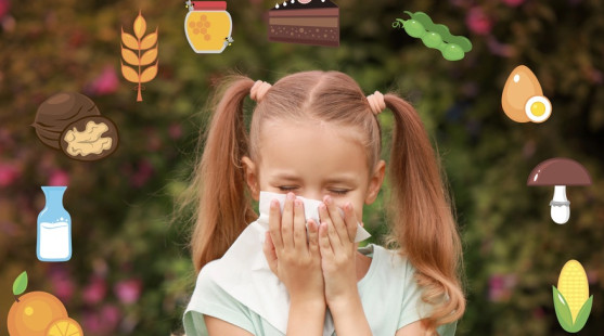 Potravinové alergie u detí: Ako ich spoznať, zvládnuť a žiť s nimi pokojne?